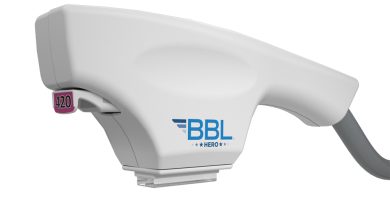 broadband light bbl photofacial ipl machine treatments benefits how it works results