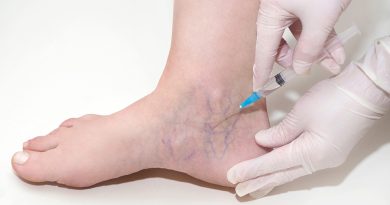 top best skin aesthetic clinics sclerotherapy in florida miami trearments