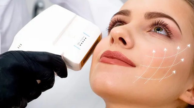 hifu ultrasound treatment aesthetic beauty skin clinics vancouver canada